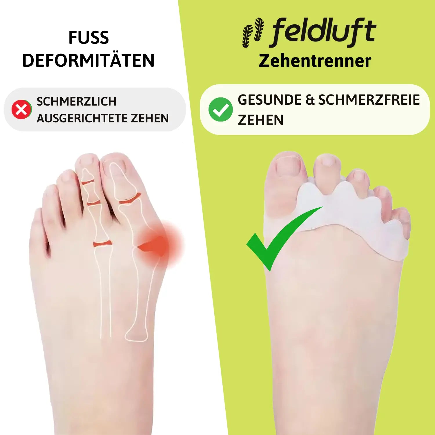 Zehentrenner - Fördert gesunde Zehen & lindert Fußschmerzen